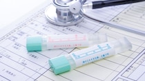 進行大腸がんでも「約20%」は便潜血で陰性？ 検査の限界を医師が解説