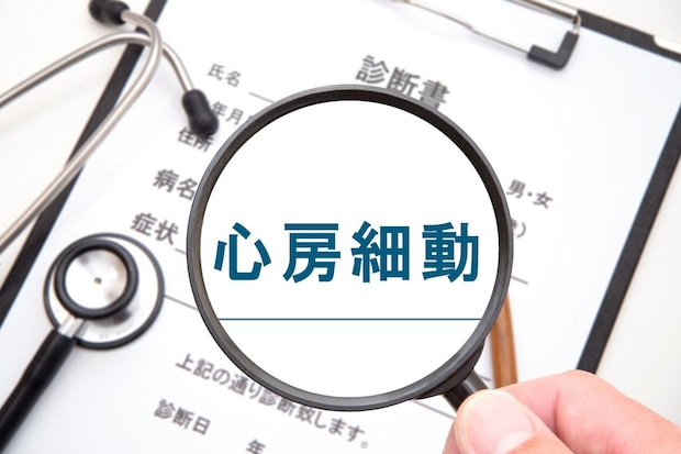 「心房細動」とは何か――なぜ脳梗塞と深くつながっているのか