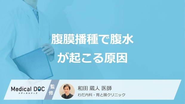 「腹膜播種で腹水」が溜まる原因はご存じですか?腹膜播種になりやすいがんも医師が解説!