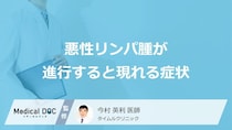「悪性リンパ腫」が進行すると現れる”5つの症状”はご存じですか？原因も医師が解説！