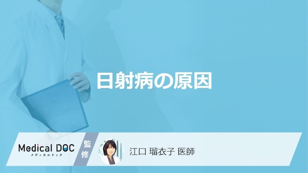 「日射病の原因」はご存知ですか?発症しやすい人の特徴も解説!【医師監修】