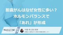 「胆嚢がん」はなぜ女性に多い？ホルモンバランスで「あれ」が形成されやすい【医師監修】