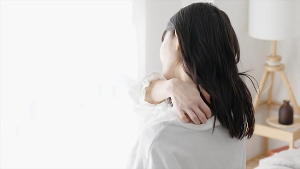 膠原病による皮膚のかゆみの特徴