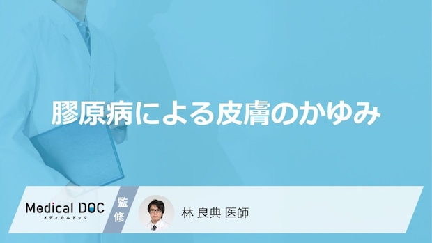 「膠原病」による「皮膚のかゆみ」の特徴はご存知ですか?原因についても解説!