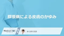 「膠原病」による「皮膚のかゆみ」の特徴はご存知ですか？原因についても解説！