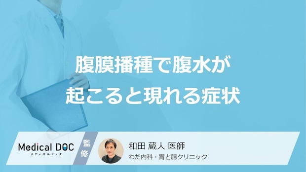 「腹膜播種」で”腹水が溜まると現れる3つの症状”はご存じですか?余命も医師が解説!