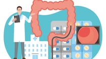 「大腸カメラ」の鎮静剤、効き方に個人差があるのをご存じですか？ 理由と検査の流れを医師が解説