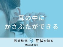 「耳の中にかさぶた」ができる原因はご存知ですか？医師が対処法も徹底解説！