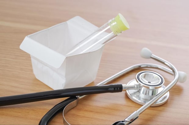 糖尿病性腎症の進行と早期発見の重要性
