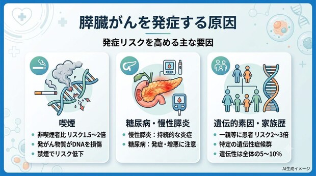 膵臓がんを発症する原因