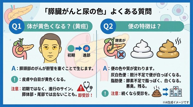 「膵臓がんと尿の色」についてよくある質問