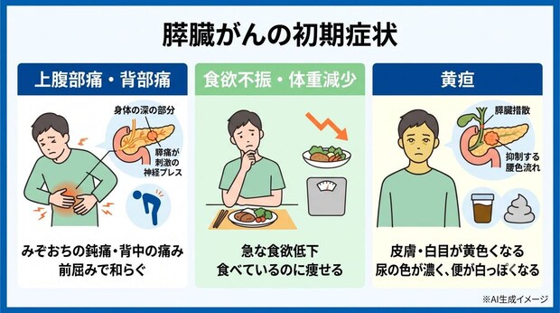 膵臓がんの初期症状