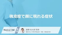 「強皮症」を発症すると「顔」にどんな症状が現れるかご存知ですか？【医師監修】
