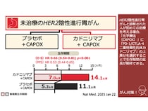 「胃がん」はカドニリマブと化学療法の併用で高い治療効果 生存期間の延長を確認