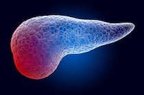 5年生存率に大きな差！ 「膵臓がん」が“早期発見”にこだわるべき本当の理由を医師が解説