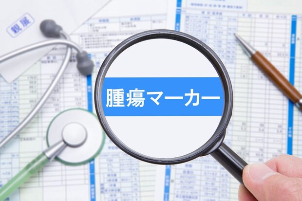 腫瘍マーカーについて