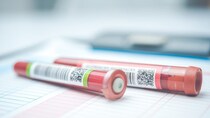 「健康診断の肝機能」は正常でも危険？ 『膵臓がん』になりやすい人の特徴【医師監修】