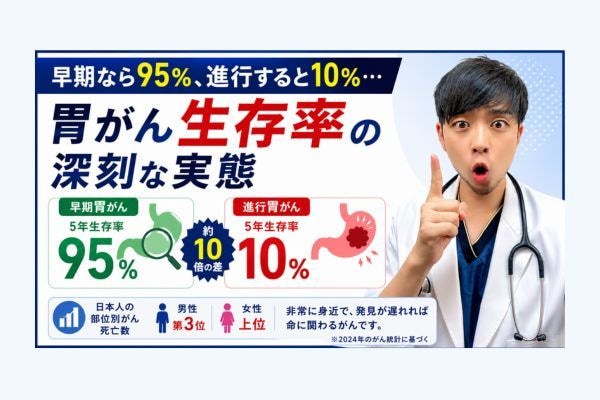 早期なら95%、進行すると10％…胃がん生存率の深刻な実態