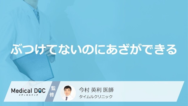 「ぶつけてないのにあざができる」原因はご存知ですか？医師が徹底解説！
