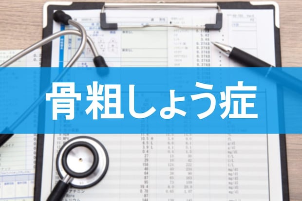 骨粗しょう症の検査とは？