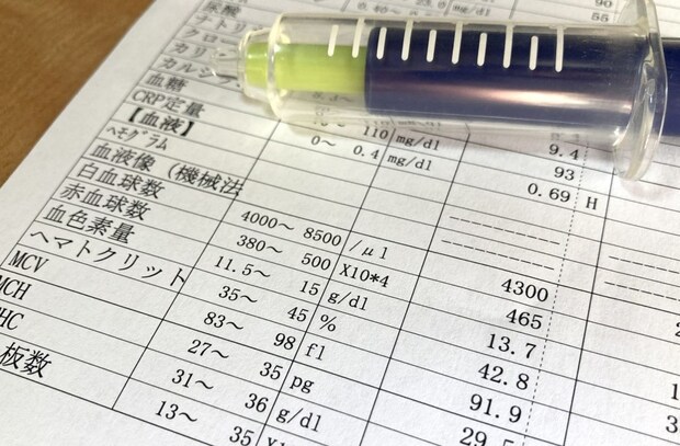 橋本病でみる主な数値