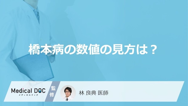 「橋本病」は検査項目の何の「数値」を確認している？数値の見方や治療の基準値も解説！