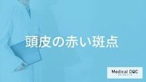 「頭皮の赤い斑点」は放置しても大丈夫？考えられる原因と対処法を医師が解説！