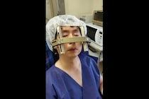【闘病】意識があるまま頭蓋骨に電極を入れる手術… 『ジストニア』との闘い