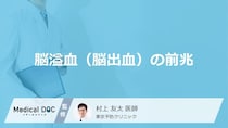 「脳溢血（脳出血）の前兆となる4つの初期症状」はご存知ですか？【医師解説】
