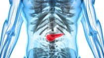早期の「膵臓がん」は専門病院でも“ほとんど発見されていない”理由を医師が解説
