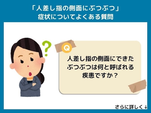 「人差し指の側面にぶつぶつ」についてよくある質問