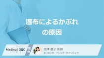 「湿布」でなぜ”かぶれ”ができるのかご存じですか？なりやすい人も医師が解説！