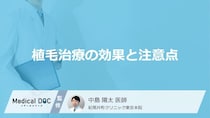 植毛した髪は「AGA」の進行で抜ける？効果の持続性や注意点を医師が解説