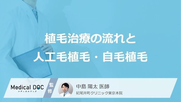 「AGA」治療の植毛とは？自毛植毛と人工毛植毛の違いや流れを医師が詳しく解説
