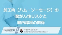 大腸がんの“原因”に？ 「加工肉」の適正量とリスクを下げる3つの習慣【医師解説】
