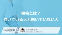 薬で改善しない「AGA」に植毛は有効？適応の基準や注意点を医師が詳しく解説