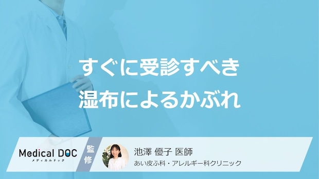 すぐに受診すべき「湿布によるかぶれ」の症状はご存じですか?医師が解説!