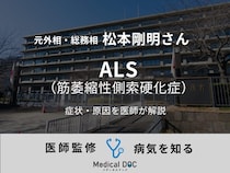 【訃報】元外相・総務相 松本剛明さんが死去。ALSの症状や原因を医師が解説