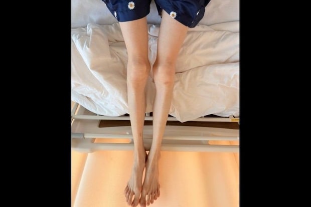 【闘病】このままでは命を落とすことも… 『摂食障害』と診断され緊急入院した過去