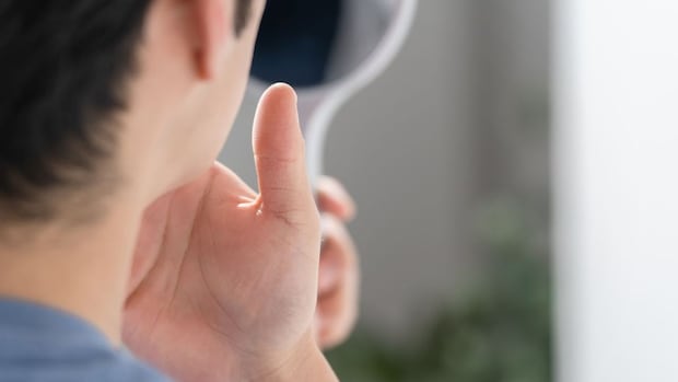 【闘病】「そんなゴツい顔してたっけ?」 容姿の変化は『先端巨大症』だった… 親戚からの指摘で発覚