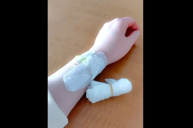 混合性結合組織病治療