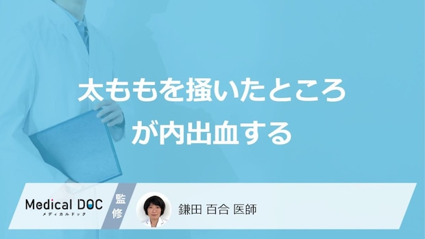 「太ももの掻いたところが内出血」が起きる原因はご存じですか?医師が解説!