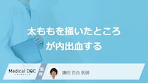 「太ももの掻いたところが内出血」が起きる原因はご存じですか？医師が解説！