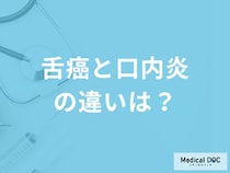 「舌癌と口内炎の違い」は？放置してはいけない”期間と症状”を医師が解説！
