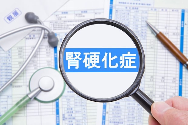 腎硬化症とは？医師が解説！