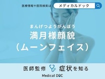 「満月様顔貌（ムーンフェイス）」を発症する原因はご存知ですか？対処法も医師が解説！