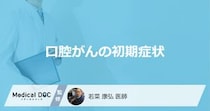 「口腔がんの初期症状」はご存知ですか？医師が監修！