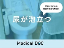 「尿が泡立つ」原因とは？女性で泡立つ原因や朝泡立つ場合も解説！