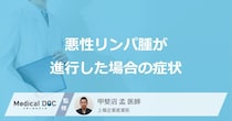 「悪性リンパ腫」が進行するとどんな症状が出るかご存知ですか？【医師解説】