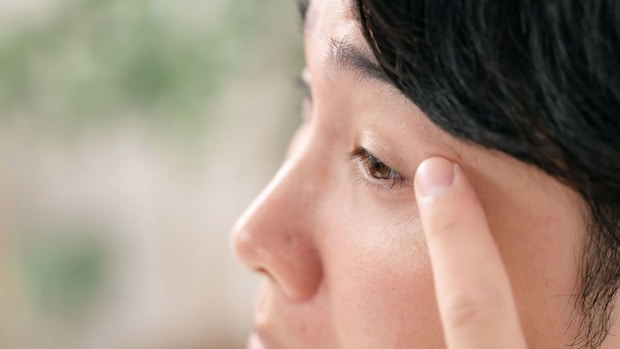 切らない『眼瞼下垂』治療とは？ 切開手術との違いや選び方【医師解説】